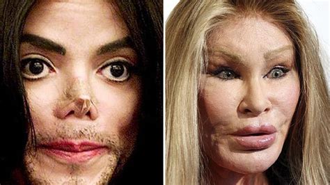 famous people who had bad plastic surgery